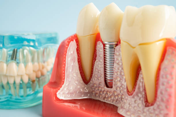 Our Range of Dental Services in Green Springs, OH